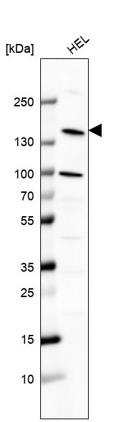 Anti-PLCB2 Antibody