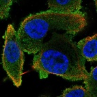 Immunofluorescent staining of human cell line PC-3 shows localization to cytosol.