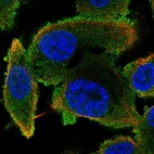 Immunofluorescent staining of human cell line PC-3 shows localization to cytosol.