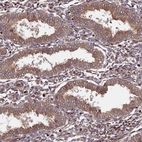 Immunohistochemical staining of human endometrium shows moderate granular cytoplasmic positivity in glandular cells.