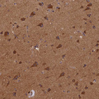 Immunohistochemical staining of human cerebral cortex shows strong granular cytoplasmic positivity in neurons.