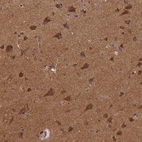 Immunohistochemical staining of human cerebral cortex shows strong granular cytoplasmic positivity in neurons.