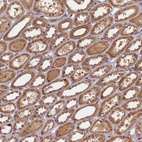 Immunohistochemical staining of human kidney shows moderate granular cytoplasmic positivity in cells in tubules.