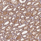 Immunohistochemical staining of human kidney shows moderate granular cytoplasmic positivity in cells in tubules.