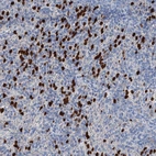 Anti-OTOA Antibody