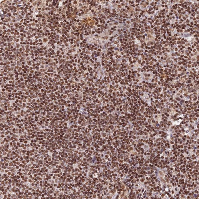 Anti-THAP11 Antibody