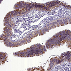 Anti-ENKD1 Antibody