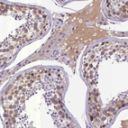 Immunohistochemical staining of human testis shows moderate cytoplasmic positivity in cells in seminiferous ducts and leydig cells.