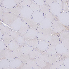 Immunohistochemical staining of human skeletal muscle shows very weak cytoplasmic positivity in myocytes.