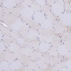 Immunohistochemical staining of human skeletal muscle shows very weak cytoplasmic positivity in myocytes.