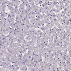 Immunohistochemical staining of human liver shows no cytoplasmic positivity in hepatocytes as expected.