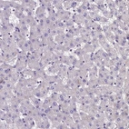 Immunohistochemical staining of human liver shows no cytoplasmic positivity in hepatocytes as expected.