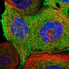 Immunofluorescent staining of human cell line A-431 shows localization to plasma membrane & cytosol.