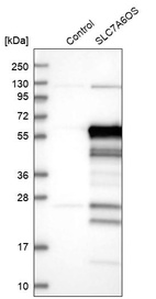 Anti-SLC7A6OS Antibody