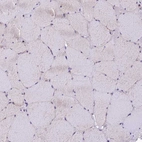 Immunohistochemical staining of human skeletal muscle shows no positivity in myocytes as expected.