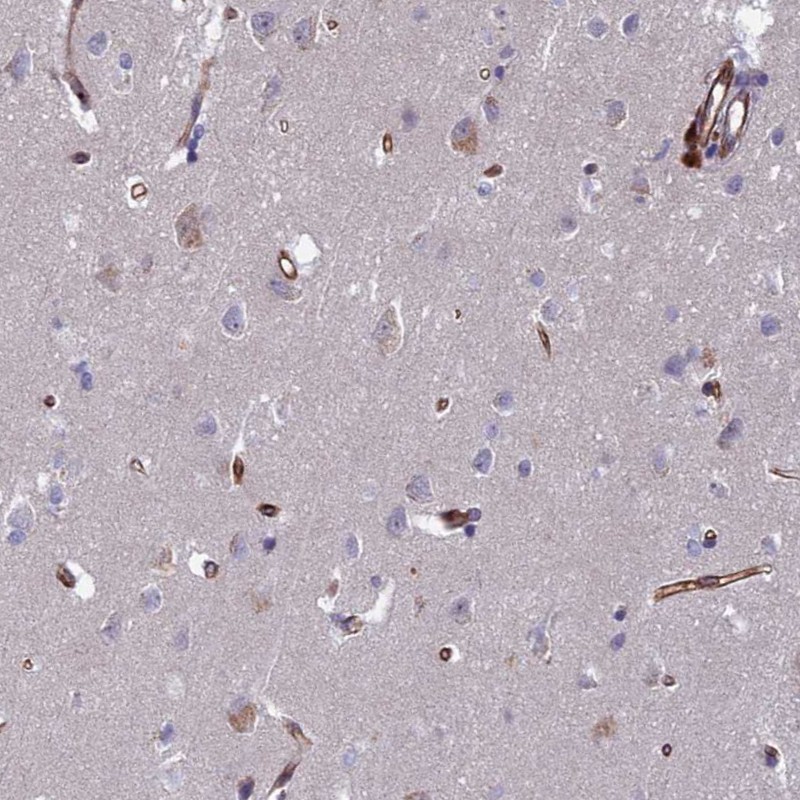 Anti-C15orf59 Antibody
