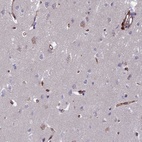 Anti-C15orf59 Antibody