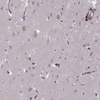Anti-C15orf59 Antibody