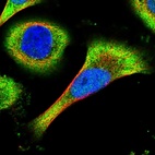 Immunofluorescent staining of human cell line U-251 MG shows localization to nucleoplasm & cytosol.