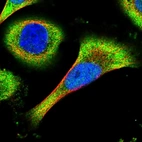 Immunofluorescent staining of human cell line U-251 MG shows localization to nucleoplasm & cytosol.
