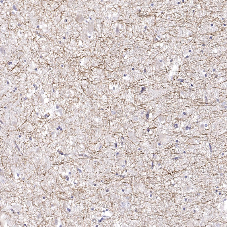 Anti-PABPC1L2A Antibody