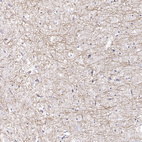 Anti-PABPC1L2A Antibody