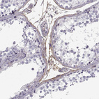 Anti-PABPC1L2A Antibody