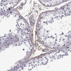 Immunohistochemical staining of human testis shows weak to moderate membranous positivity in peritubular myoid cells.