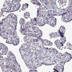 Immunohistochemical staining of human placenta shows no positivity in trophoblastic cells as expected.