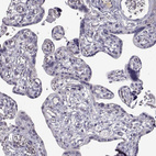 Anti-PABPC1L2A Antibody