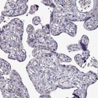 Immunohistochemical staining of human placenta shows no positivity in trophoblastic cells as expected.