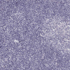 Immunohistochemical staining of human lymphoid tissues shows no positivity in non-germinal center cells as expected.