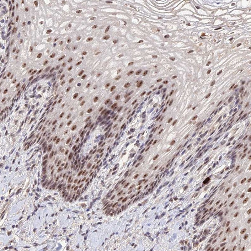 Anti-CD3EAP Antibody
