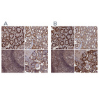 Anti-PLA2G15 Antibody