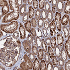Immunohistochemical staining of human kidney shows strong granular cytoplasmic positivity in cells in tubules.