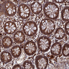 Immunohistochemical staining of human colon strong granular cytoplasmic positivity in glandular cells.