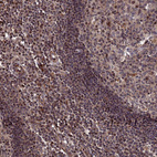 Immunohistochemical staining of human colon strong granular cytoplasmic positivity in glandular cells.
