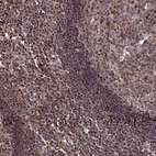 Immunohistochemical staining of human colon strong granular cytoplasmic positivity in glandular cells.