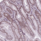 Anti-TIGD1 Antibody