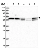Lane 1: Marker [kDa] 250, 130, 95, 72, 55, 36, 28, 17, 10_br/_Lane 2: Human cell line RT-4_br/_Lane 3: Human cell line U-251MG sp_br/_Lane 4: Human plasma (IgG/HSA depleted)_br/_Lane 5: Human liver tissue_br/_Lane 6: Human tonsil tissue