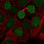 Immunofluorescent staining of human cell line MCF7 shows localization to nucleoli & nuclear bodies.