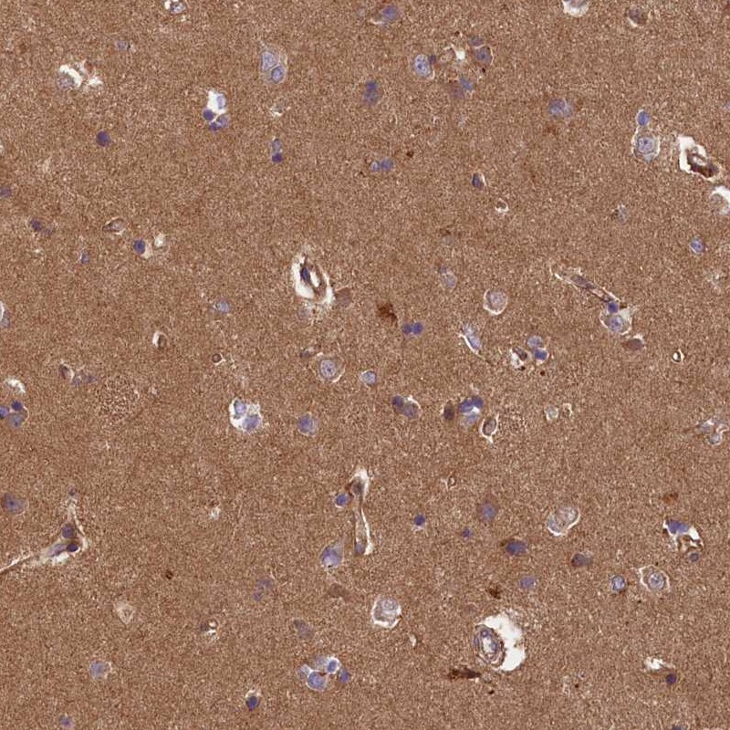 Anti-ERMARD Antibody