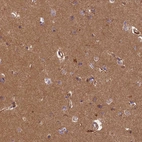 Anti-ERMARD Antibody