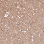 Immunohistochemical staining of human cerebral cortex shows moderate cytoplasmic positivity in neuropil.