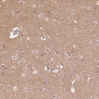 Immunohistochemical staining of human cerebral cortex shows moderate cytoplasmic positivity in neuropil.