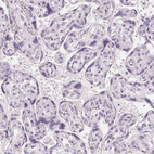 Immunohistochemical staining of human placenta shows no positivity in trophoblastic cells as expected.