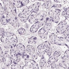 Immunohistochemical staining of human placenta shows no positivity in trophoblastic cells as expected.