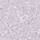 Immunohistochemical staining of human liver shows no positivity in hepatocytes as expected.