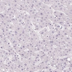 Immunohistochemical staining of human liver shows no positivity in hepatocytes as expected.