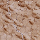 Immunohistochemical staining of human skeletal muscle shows strong cytoplasmic positivity in myocytes.